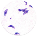 TOXOPLASMA