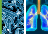 MOLgen Respiratory and Tuberculosis Panels